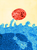 Theileria parva Infecting Lymphocyte,TEM