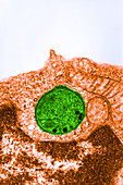 Theileria parva Infecting Lymphocyte,TEM