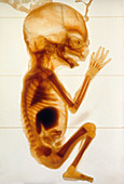 Human Fetus at 4 Months