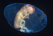 Human Embryo,6-8 Weeks