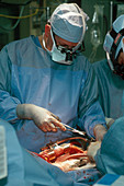 Heart Transplant Surgery