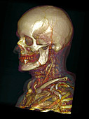 Male Skull & Arterial System