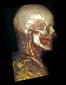 Male Skull & Arterial System