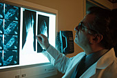 Podiatrist Examining X-rays
