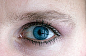 Blue Eye With Contact Lens