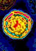 Hepatitis B Virus