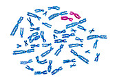 Human Karyotype