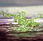 Bacteria,Treponema pallidum,SEM