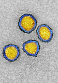 TEM of Hepatitis C Virus