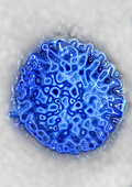 TEM of Rotavirus