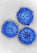 TEM of Rotavirus
