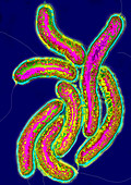Cholerae bacteria,TEM