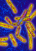 Listeria bacteria,TEM