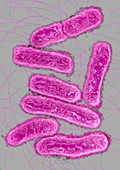 Salmonella bacteria,TEM