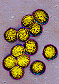 Staphylococcus aureus,TEM