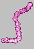 Streptococcus pyogenes ,TEM