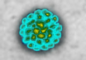 TEM of Polyomavirus