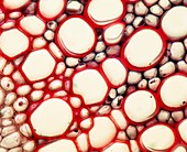 Plant xylem tissue,light micrograph