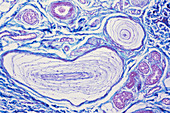 Pacinian Corpuscles,LM