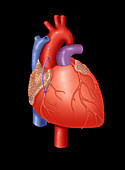 Coronary Vein Graft