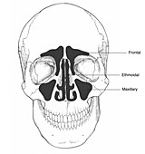 Illustration of Sinus Cavities