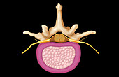 Lumbar Vertebra and Normal Disk