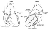 Illustration of Coronary Arteries