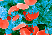 Red Blood Cells,SEM