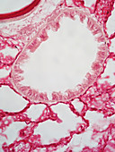 LM of Lung Bronchiole
