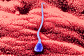 Human sperm in uterus