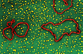 DNA From Bacteriophage (TEM)