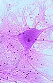Motor Neuron from Spinal Cord
