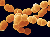 Streptococcus thermophilus bacteria (SEM)