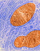 Mitochondrion and Endoplasmic Reticulum