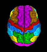 MRI of Normal Brain