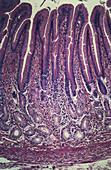 Pyloric Region of Stomach,LM
