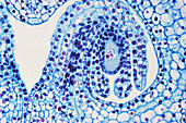 LM of Ovary for Young Ovules in Lilium