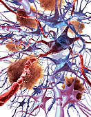 Neuronal Apoptosis In Alzheimer's Disease