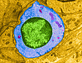 Smooth Muscle Cell,TEM