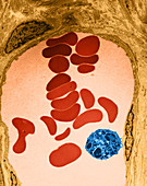 RBCs and Granulocyte,TEM