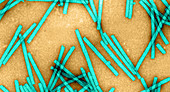 Tobacco Mosaic Virus,TEM