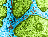 Interdigitating Membrane,TEM