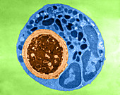 Lymphocyte Digesting Yeast Cell,TEM