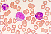 Normal blood smear,light micrograph