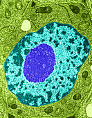 Nucleus in Root Tip Cell,TEM