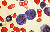 Mitosis in Blood Marrow Cells,LM