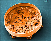 Diatom (Aulacodiscus sp.)