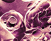 Myelinated Nerve Axons and Schwann Cells