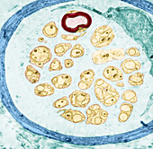 Nerve with Axons (TEM)