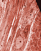 TEM of Auerbach's Nerve Plexus